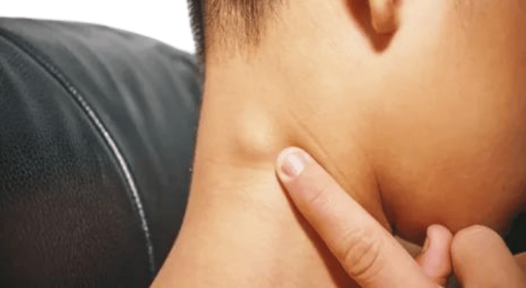 Do you have a lump in your neck, back, or behind your ear? Here’s what you need to know