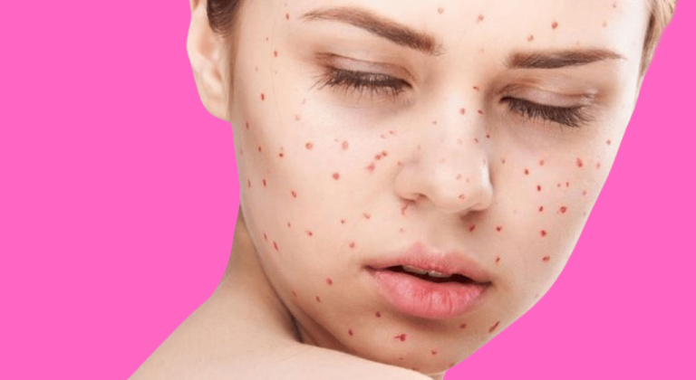 The presence of red dots on your skin.. What does this mean?