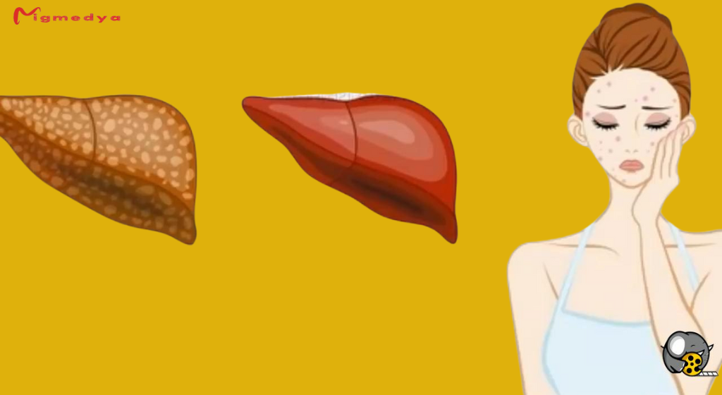 Read more about the article Pay attention.. 6 warning signs that tell you that your liver is full of toxins