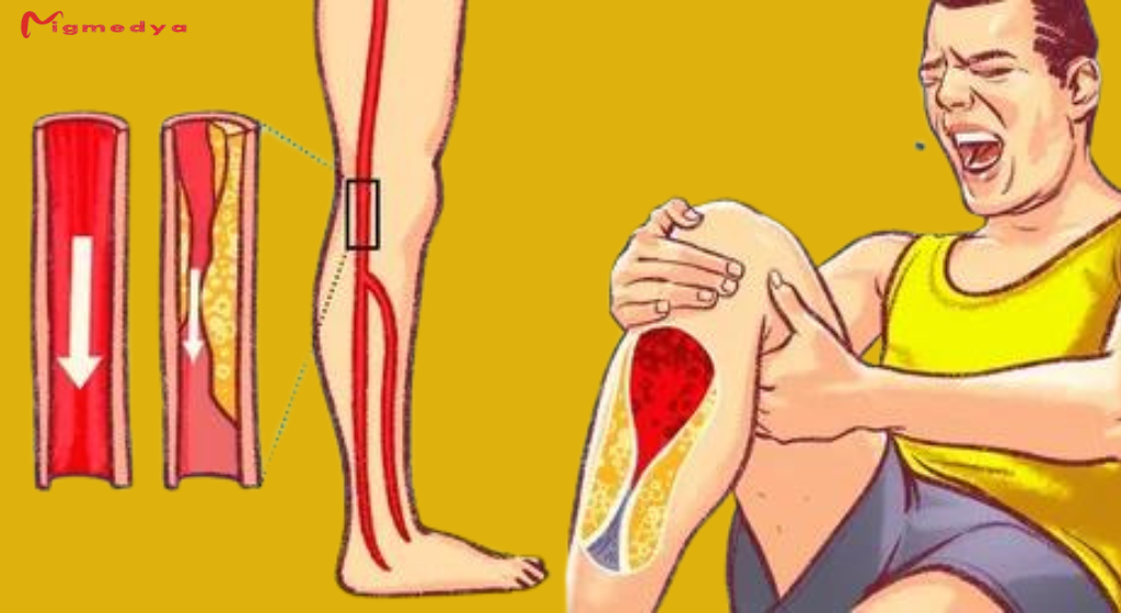 You are currently viewing Here Are 7 Warning Signs You Have Blocked Arteries