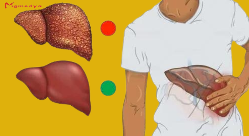 10 Warning Signs of Liver Damage You Shouldn’t Ignore