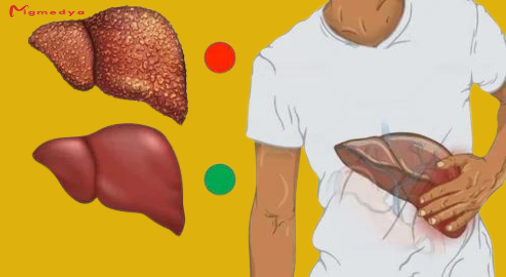 You are currently viewing 10 Warning Signs of Liver Damage You Shouldn’t Ignore