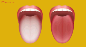 Read more about the article What does your tongue say about your health?