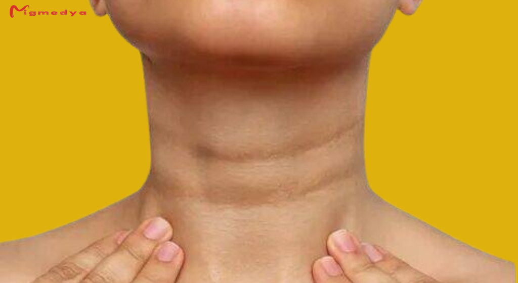 Neck wrinkles treatment | Natural causes and methods