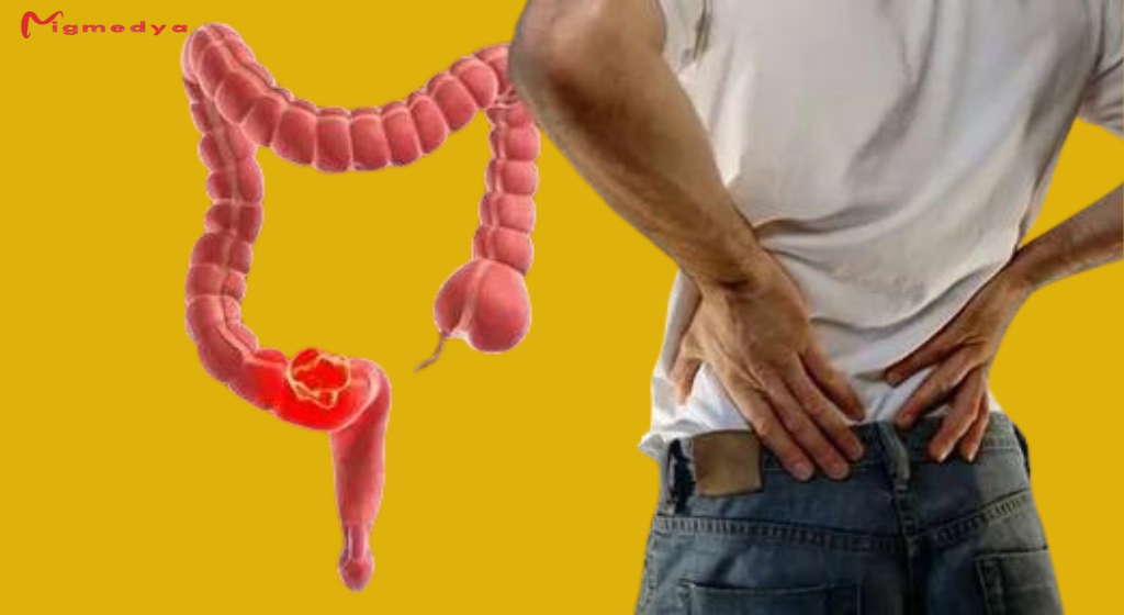 Learn about the first signs of rectal cancer