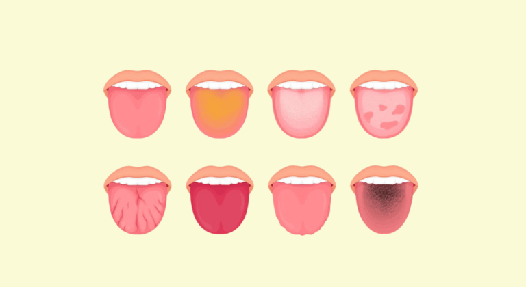 What does your tongue say about your health?