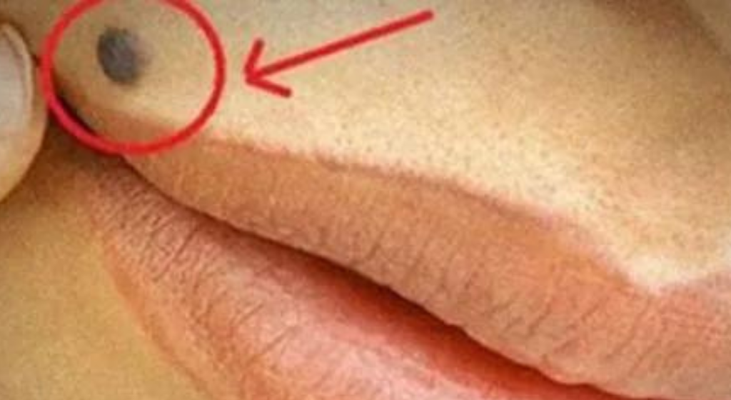 Discover the Surprising Meanings Behind Moles Located on These 7 Areas of Your Body!