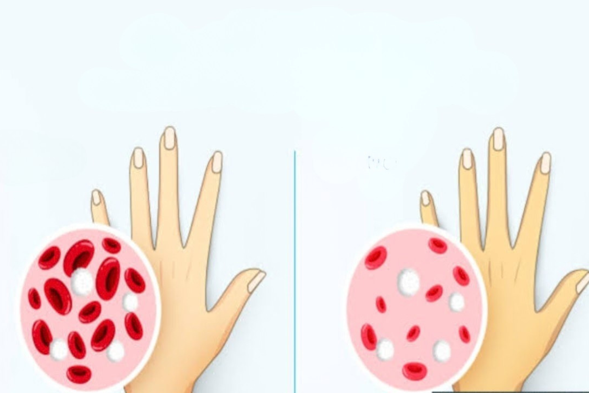 Recognizing the Initial Symptoms of Anemia That Deserve Your Attention