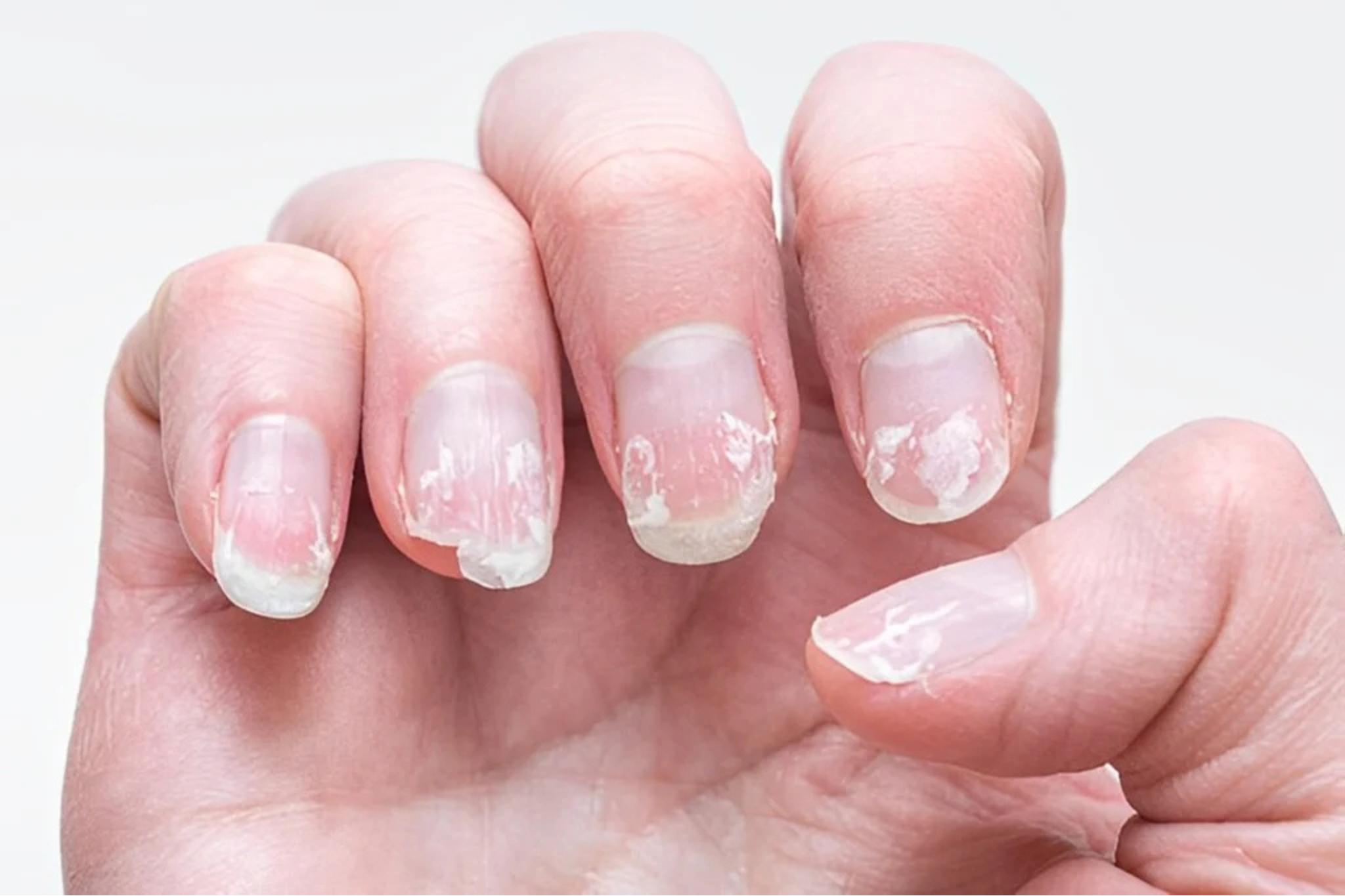 Rub a little baking soda on your nails and see what happens? This trick will change your life