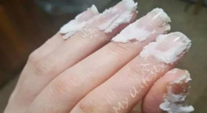 Read more about the article Rub a little baking soda on your nails and see what happens? This trick will change your life