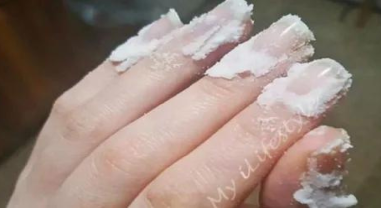 Rub a little baking soda on your nails and see what happens? This trick will change your life